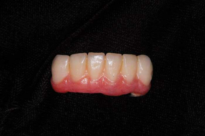 Resina Sinfony (Novo)